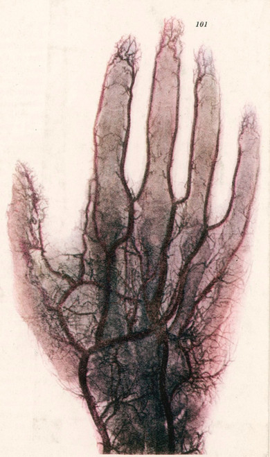 X-ray Poster Print by Science Source - Item # VARSCIBD9304