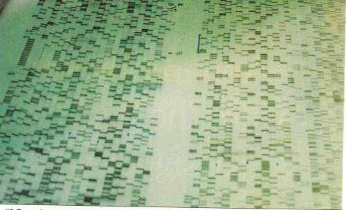 DNA Sequencing Gel Poster Print by Science Source - Item # VARSCIBT6969