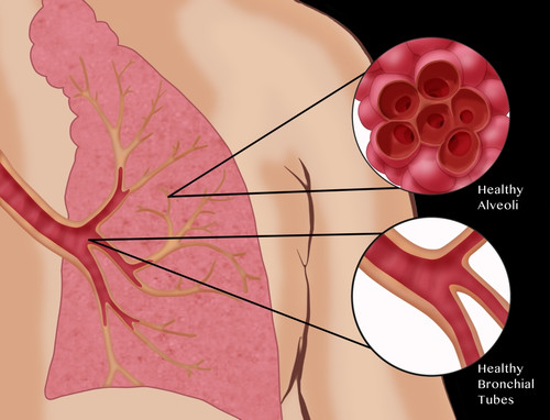 Healthy Lungs Poster Print by Monica Schroeder/Science Source