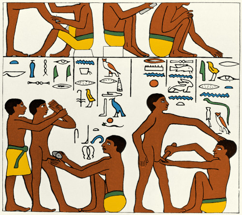 Circumcision, Ancient Egypt, 2600 BC Poster Print by Science Source - Item # VARSCIJE9329