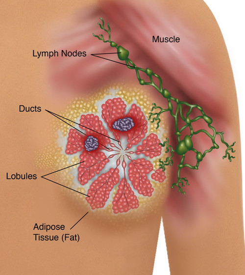 Breast Cancer Poster Print by Gwen Shockey/Science Source - Item # VARSCIBX8335