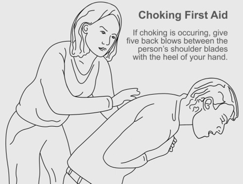 Choking First Aid Chart Poster Print By Gwen Shockeyscience Source Item Varsciby1895 7444