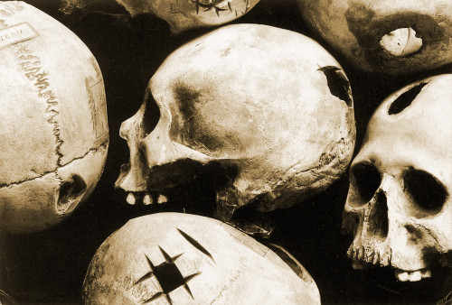 Skulls Showing Trepanation Poster Print by Science Source - Item # VARSCIBP9645