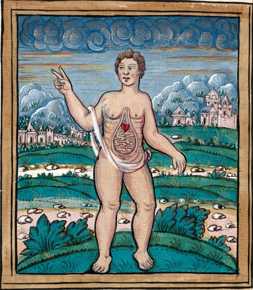 Child Born with Intestines Exposed, 1560 Poster Print by Science Source - Item # VARSCIJB5425
