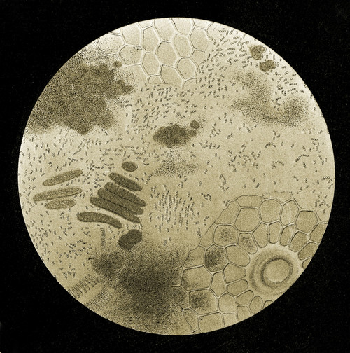 Diseases in Silkworms, 1870 Poster Print by Science Source