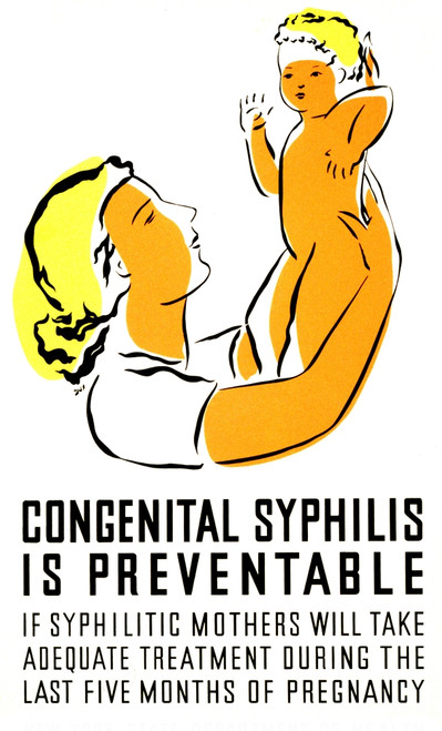 Syphilis Treatment, FAP Poster, 1939 Poster Print by Science Source - Item # VARSCIJC3008