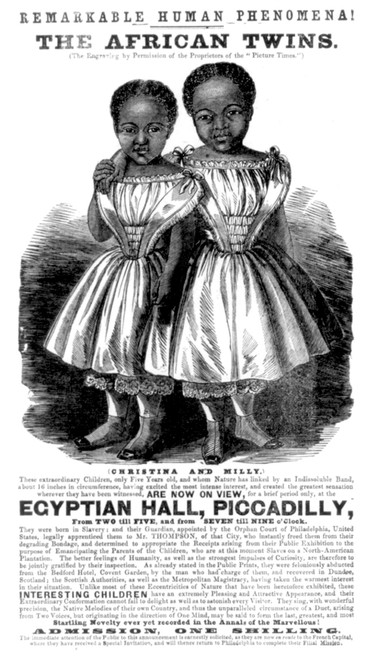The McCoys, Conjoined Twins, 1855 Poster Print by Science Source - Item # VARSCIJC0449