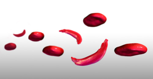 Sickle Cells, Illustration Poster Print by Spencer Sutton/Science Source - Item # VARSCIJA6004