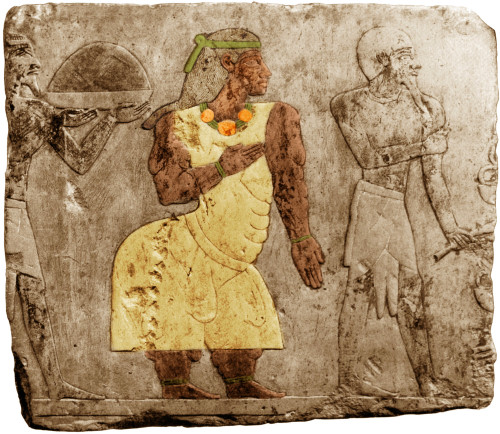 Muscular Dystrophy, Ancient Egypt Poster Print by Science Source - Item # VARSCIBS3358