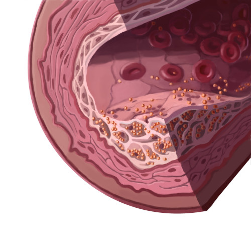 Cholesterol Poster Print by Spencer Sutton/Science Source - Item # VARSCIBW1483
