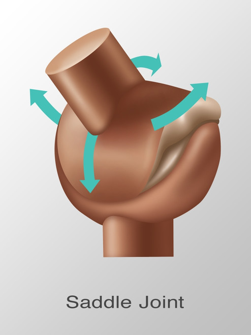 Saddle Joint Replacement, Illustration Poster Print by Gwen Shockey/Science Source - Item # VARSCIJB8535