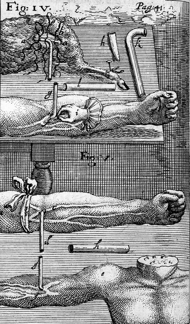 Techniques of Blood Transfusion, 1667 Poster Print by Science Source - Item # VARSCIJA0943