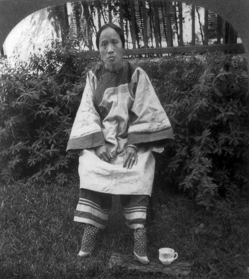 China: Lily Food, C1905. /Na 'Lily Footed' Woman Of China. Stereograph, C1905. Poster Print by Granger Collection - Item # VARGRC0105595 China: Lily Food, C1905. /Na 'Lily Footed' Woman Of China. Stereograph, C1905. Poster Print by Granger Collection - Item # VARGRC0105595