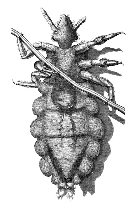 Hooke: Louse, 1665. /Na Louse, As Seen By Robert Hooke With His Microscope. Copper Engraving From Hooke'S 'Micrographia,' 1665. Poster Print by Granger Collection - Item # VARGRC0033732