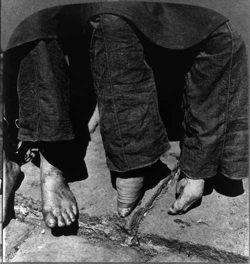 China: Lily Foot, C1902. /Na 'Lily Footed' Chinese Woman Seated Beside A Woman With Natural Feet. Photograph, C1902. Poster Print by Granger Collection - Item # VARGRC0115964 China: Lily Foot, C1902. /Na 'Lily Footed' Chinese Woman Seated Beside A Woman With Natural Feet. Photograph, C1902. Poster Print by Granger Collection - Item # VARGRC0115964
