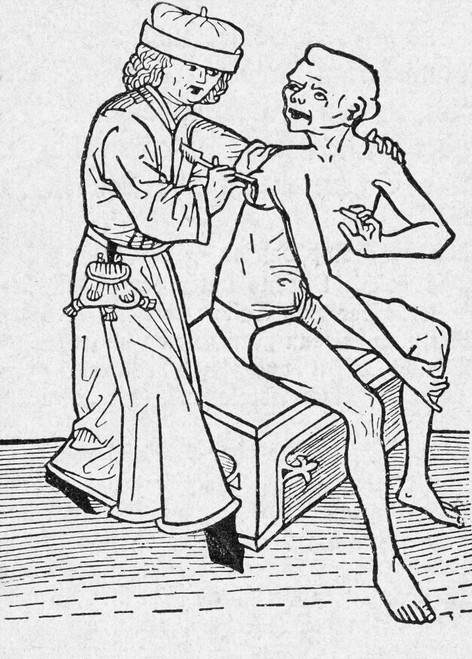 Physician Lancing Wound Poster Print by Science Source - Item # VARSCIBN2341