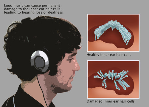 Headphones, Hearing Protection or Damage Poster Print by Gwen Shockey/Science Source - Item # VARSCIJA8116