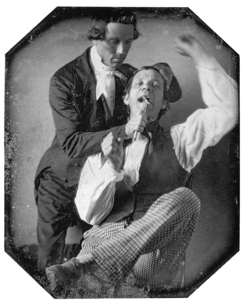 Dentist And Patient, 1845. /Ndentist Pulling Teeth. American Daguerreotype, C1845. Poster Print by Granger Collection - Item # VARGRC0077909