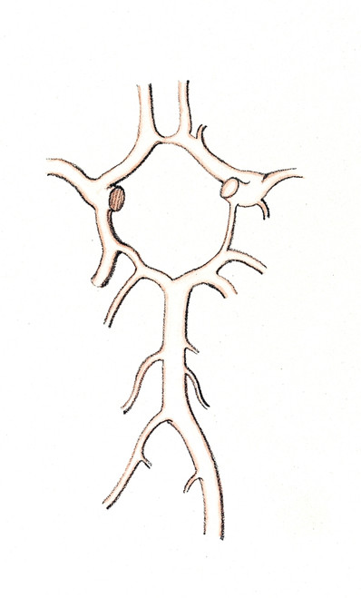 Arteries at Brain Base, Circle of Willis Poster Print by Science Source - Item # VARSCIJB5970