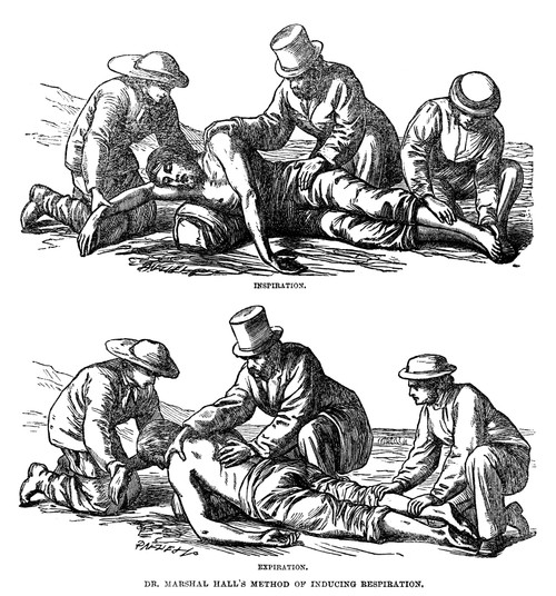 Artificial Respiration, 1864. /Ndr. Marshall Hall'S Method For Artificial Respiration Of A Drowned Person. Wood Engraving, English, 1864. Poster Print by Granger Collection - Item # VARGRC0267946