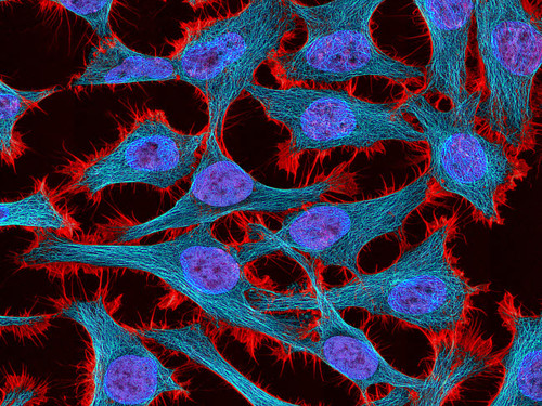 Multiphoton fluorescence image of HeLa cells Poster Print by National Institutes of Health/Stocktrek Images - Item # VARPSTNIH700082H