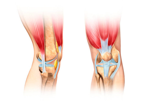 Human knee cutaway illustration Poster Print by Leonello Calvetti/Stocktrek Images - Item # VARPSTVET700064H
