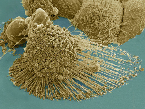Scanning electron micrograph of an apoptotic HeLa cell Poster Print by National Institutes of Health/Stocktrek Images - Item # VARPSTNIH700087H