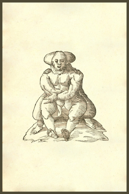 Monstrum bisrons, monster with two bodies, siamese twins.   From the 1642 book Monstrorum Historia by Ulisse Aldrovandi .   He is considered the founder of modern Natural History. Poster Print by Ulisse Aldrovandi - Item # VARBLL0587417951
