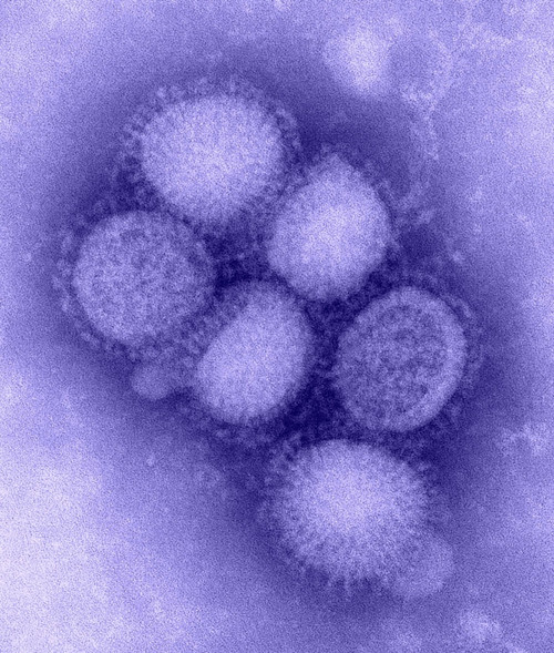 Swine Flu Virus. Negative Stained Transmission Electron Micrograph. Photo By C. S. Goldsmith And A. Balish History - Item # VAREVCHISL015EC219