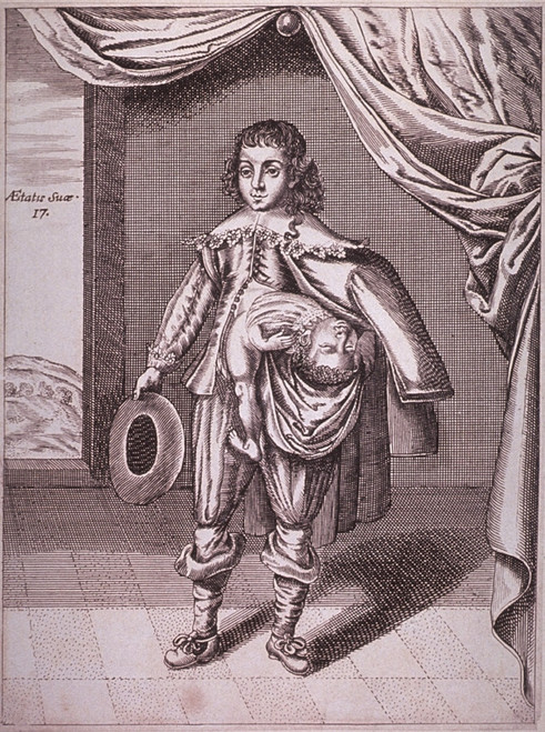 Boy With A Deformity Caused By A Partial Conjoined Twin Growing From His Side. 1686 Engraving. History - Item # VAREVCHISL015EC011
