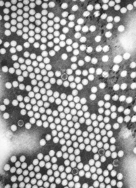 Electron Micrograph Of The Poliovirus. 1975. History - Item # VAREVCHISL016EC040
