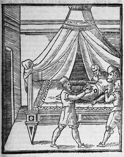 A Woman Lying On A Bed Is Being Restrained By Two Male Assistants While The Surgeon Extracts The Infant During A Cesarean Section. The Operation Was Fatal To Most Women History - Item # VAREVCHISL015EC063