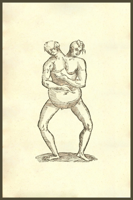 Monstrum hermaphroditicum biceps aliud, monster with one body and two heads .   From the 1642 book Monstrorum Historia by Ulisse Aldrovandi .   He is considered the founder of modern Natural History. Poster Print by Ulisse Aldrovandi - Item # VARBLL0