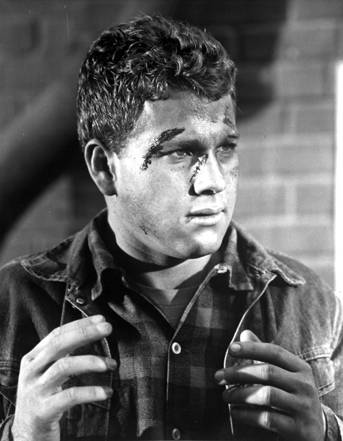 Ryan O'Neal with injuries Photo Print - Item # VARCEL684368