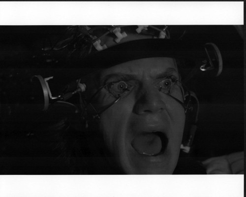 Malcolm Mcdowell With Eyes Held Open In A Clockwork Orange Photo Print