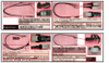 SPS-Cable Kit; 2/4/8 LFF SAS/SATA - P24553-001