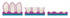 3M Trizact Cloth Belt 237AA, A45 X-weight, 1-1/2 in x 72 in, Film-lok,
Full-flex, Scallop A, 50 ea/Case