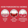 Parodontax Whitening Toothpaste for Bleeding Gums, 3.4 Ounces