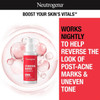 Neutrogena Stubborn Marks PM Treatment with Retinol SA, Face-Exfoliating Treatment to Help Reverse the Look of Post-Acne Marks & Uneven Skin Tone, Oil-Free, Non-Comedogenic, PM Treatment, unscented, 1.0 Fl Oz