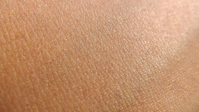 INFLAMMATION AND ITS EFFECTS ON THE SKIN