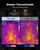 Pro Thermal Imaging Camera, Upgraded 512 x 384 TISR Super Resolution, 3.45" LCD Infrared Thermal Im E415-FWIFIYHWRXY32CPHW002V9
