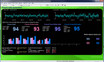 Z-Score 6 Suite - SA7965