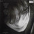 Ian McCulloch (Echo & Bunnymen) - Candleland LP used Canada NM/NM