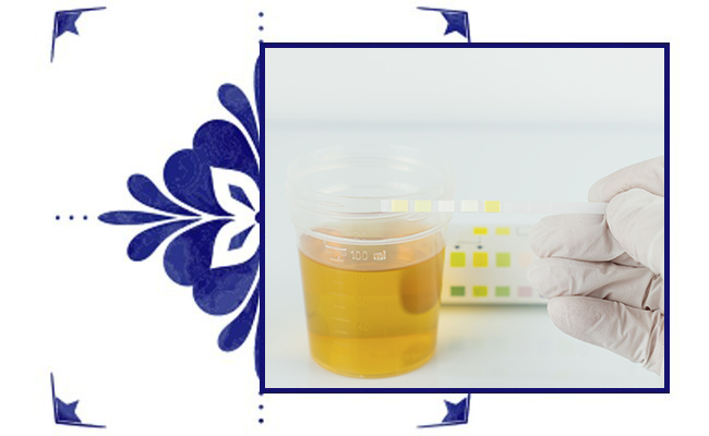 Test de orina y test de drogas en Farmacia Albarreal, en Marchena, Sevilla
