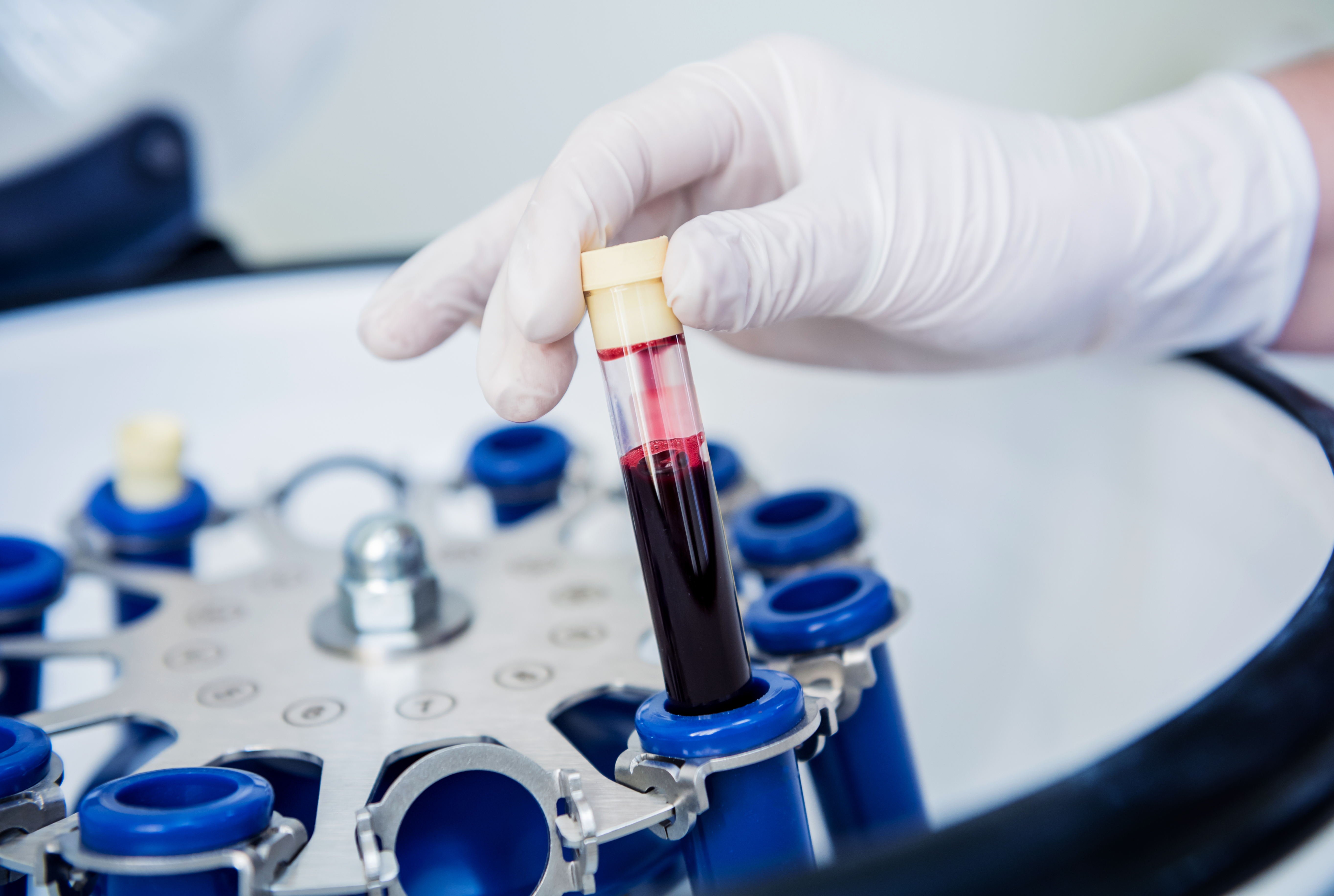 Analíticas de hemoglobina glicada en  Farmacia Albarreal en Marchena, Sevilla