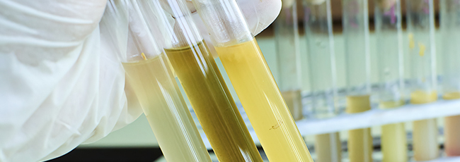 Urinal test stada en Farmacia Albarreal, en Marchena, Sevilla