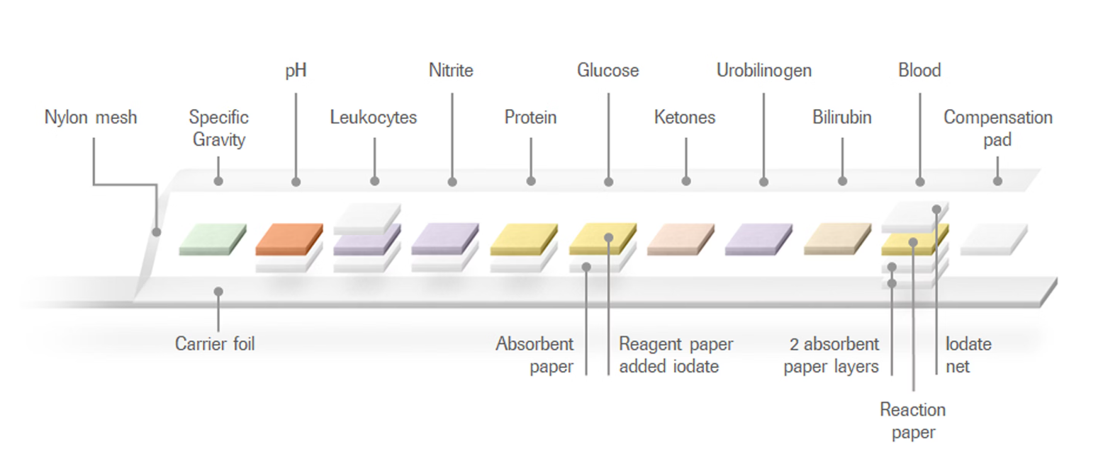 Combur Test: A Reliable Solution for Rapid and Accurate Urinalysis