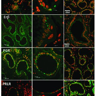 examples-of-laser-scanning-confocal-fluorescence-lsc-lens-6303-oil-images-of-igs-one-q320.jpg