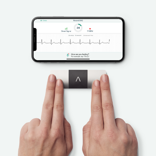 KardiaMobile Six Lead Electrocardiogram
