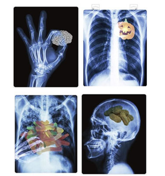 WINDOW DECOR XRAY 4AST 17X21IN GEL ADHESIVE/HALLOWEEN HANGTAG WINDOW DECOR XRAY 4AST 17X21IN GEL ADHESIVE/HALLOWEEN HANGTAG